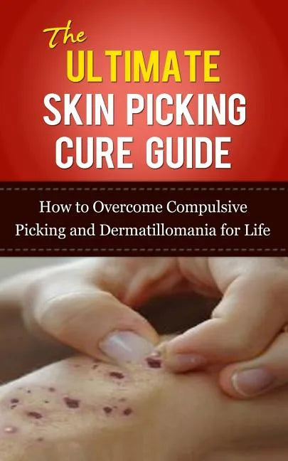 The Ultimate Skin Picking Cure Guide: How to Overcome Compulsive Picking and Dermatillomania for Life - Paperback
