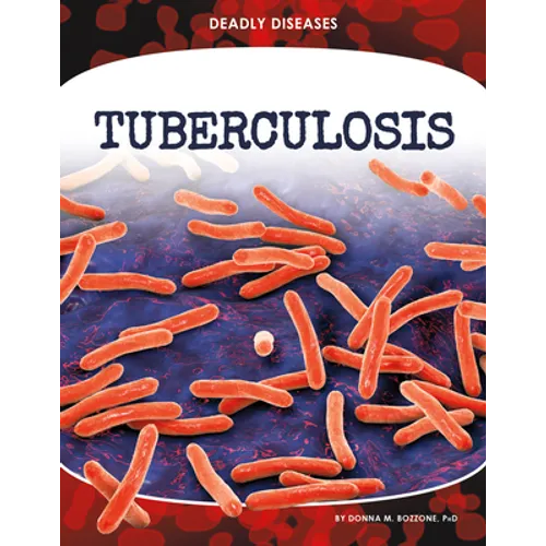 Tuberculosis - Library Binding