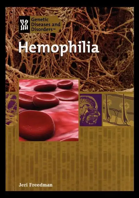 Hemophilia - Paperback