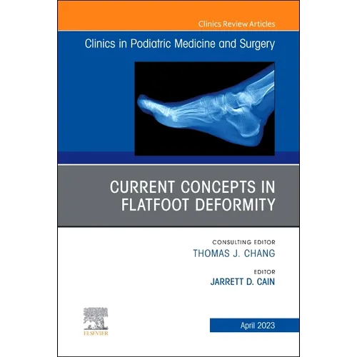 Current Concepts in Flatfoot Deformity, an Issue of Clinics in Podiatric Medicine and Surgery: Volume 40-2 - Hardcover