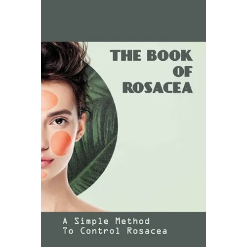 The Book Of Rosacea- A Simple Method To Control Rosacea: Rosacea Treatment For Face - Paperback