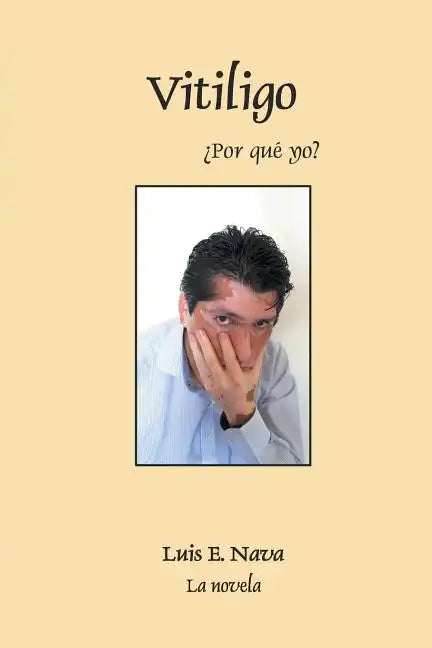 Vitiligo - Paperback