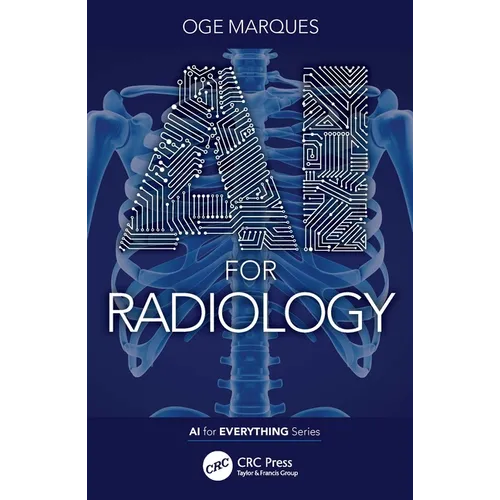 AI for Radiology - Paperback