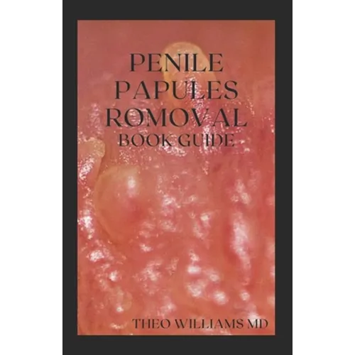 Penile Papules Romoval Book Guide: The Ultimate Guide On How To Remove Pearly Penile Papules Using Natural Remedies - Paperback