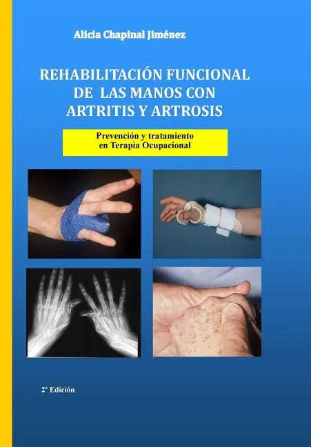 Rehabilitación funcional de las manos con artritis y artrosis: Prevención y tratamiento - Paperback