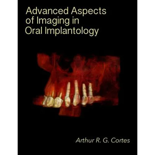 Advanced Aspects of Imaging in Oral Implantology - Paperback