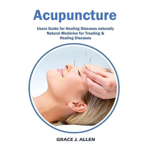 Acupuncture: Users Guide for Healing Diseases naturally Natural Medicine for Treating & Healing Diseases - Paperback