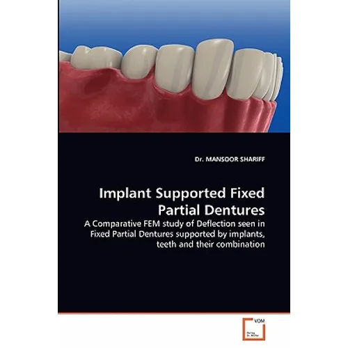 Implant Supported Fixed Partial Dentures - Paperback