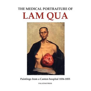The Medical Portraiture of Lam Qua: Paintings from a Canton hospital 1836-1855 - Paperback