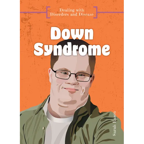 Down Syndrome - Library Binding