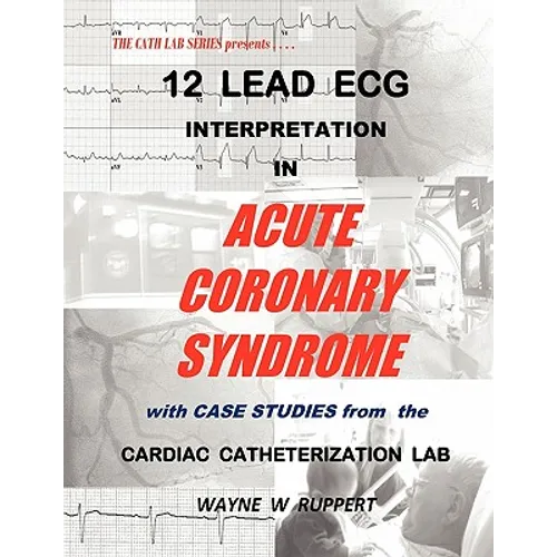 12 Lead ECG Interpretation in Acute Coronary Syndrome with Case Studies from the Cardiac Catheterization Lab - Paperback