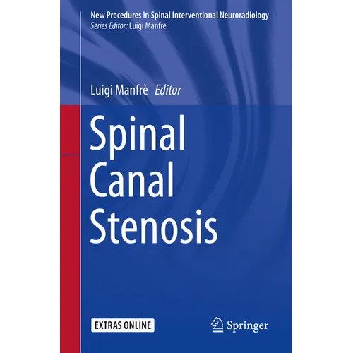 Spinal Canal Stenosis - Paperback