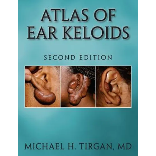 Atlas of Ear Keloids - Second Edition - Paperback