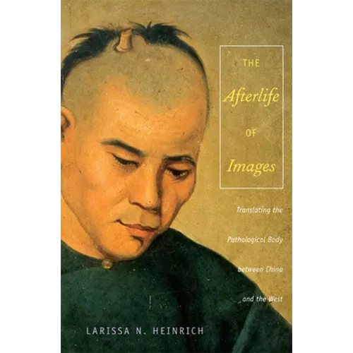The Afterlife of Images: Translating the Pathological Body between China and the West - Paperback