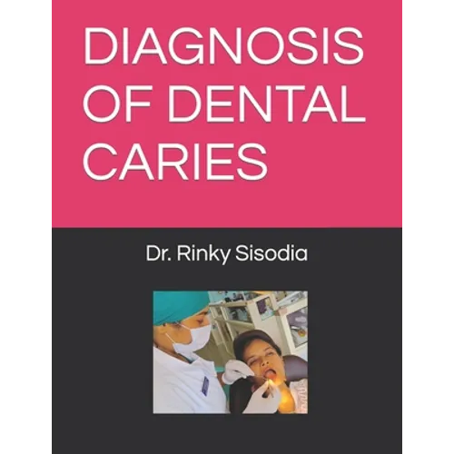 Diagnosis of Dental Caries - Paperback