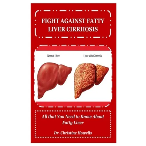 Fight Against Fatty Liver Cirrhosis: All that You Need to Know About Fatty Liver - Paperback
