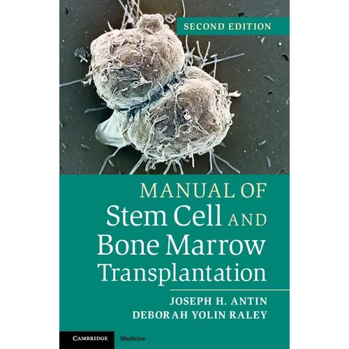 Manual of Stem Cell and Bone Marrow Transplantation - Paperback