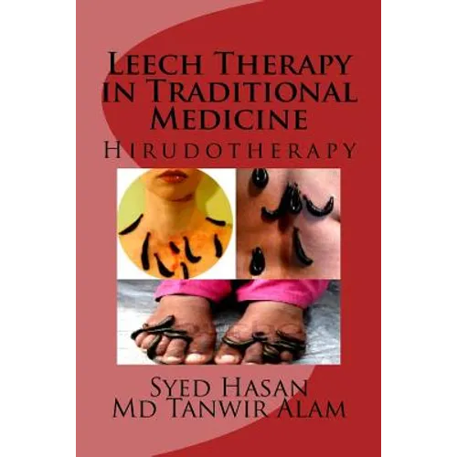 Leech Therapy in Traditional Medicine: Hirudotherapy - Paperback