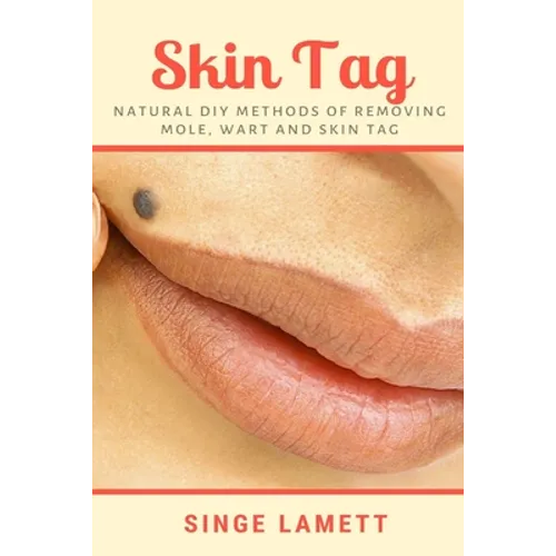 Skin Tag: Natural DIY Methods of removing Mole, Wart and Skin Tag - Paperback