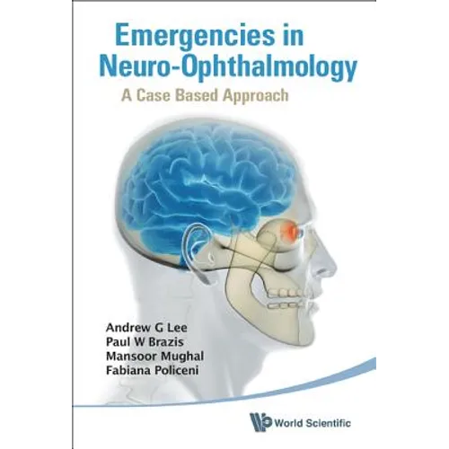 Emergencies in Neuro-Ophthalmology: A Case Based Approach - Hardcover