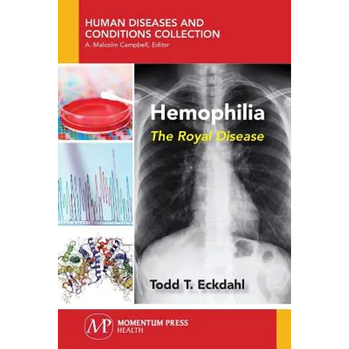 Hemophilia: The Royal Disease - Paperback
