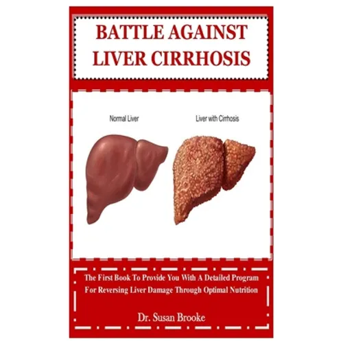 Battle Against Liver Cirrhosis: The First Book To Provide You With A Detailed Program For Reversing Liver Damage Through Optimal Nutrition - Paperback