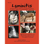 Laminitis: An Equine Plague of Unconscionable Proportions: Healing and Protecting Your Horse Using Natural Principles & Practices - Paperback