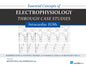 Essential Concepts of Electrophysiology Through Case Studies: Intracardiac EGMs: Intracardiac EGMs - Paperback