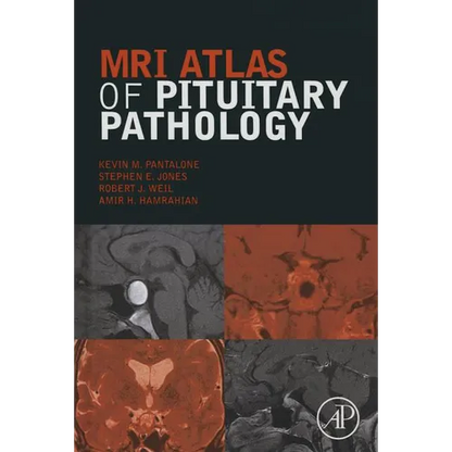 MRI Atlas of Pituitary Pathology - Hardcover