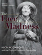 Face of Madness: Hugh W. Diamond and the Origin of Psychiatric Photography - Hardcover