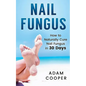 Nail Fungus: How to Naturally Cure Nail Fungus in 30 Days: Natural remedies, homeopathy for toenail fungus - Paperback