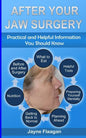 After Your Jaw Surgery: Practical and Helpful Information You Should Know - Paperback