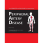 Your Complete and Easy Guide to Understanding Peripheral Artery Disease - Paperback