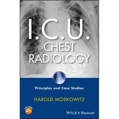 I.C.U. Chest Radiology: Principles and Case Studies [With CDROM] - Hardcover