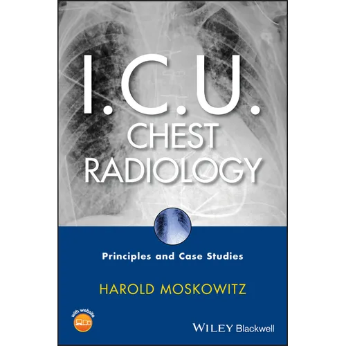 I.C.U. Chest Radiology: Principles and Case Studies [With CDROM] - Hardcover