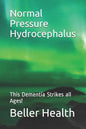 2019 Normal Pressure Hydrocephalus: This Dementia Strikes all Ages! - Paperback