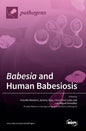 Babesia and Human Babesiosis - Hardcover