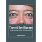 Thyroid Eye Disease: Understanding Graves' Ophthalmopathy - Hardcover