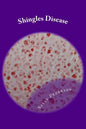 Shingles Disease: The Complete Guide - Paperback