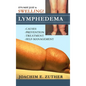 It's Not Just a Swelling! Lymphedema: Causes, Prevention, Treatment, Self-Management - Hardcover