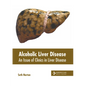 Alcoholic Liver Disease: An Issue of Clinics in Liver Disease - Hardcover