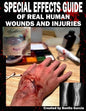 Special Effects Guide Of Real Human Wounds and Injuries: Special Effects Guide Of Real Human Wounds and Injuries - Paperback