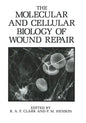 The Molecular and Cellular Biology of Wound Repair - Paperback