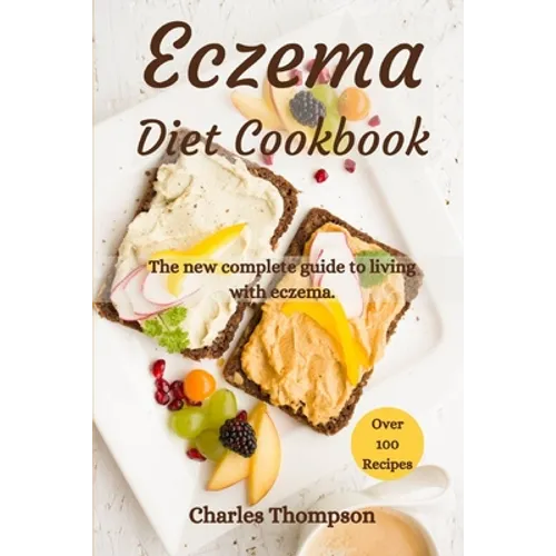 Eczema Diet Cookbook: The new complete guide to living with eczema. More than 100 recipes against the symptoms of dermatitis and psoriasis. - Paperback