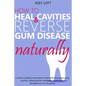 How to Heal Cavities and Reverse Gum Disease Naturally: a science-based, proven plan to heal teeth and gums using nutrition, balancing the metabolism, - Paperback
