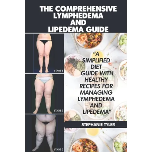 The Comprehensive Lymphedema and Lipedema Guide: The Comprehensive Lymphedema and Lipedema Guide - Paperback
