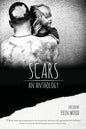Scars: An Anthology - Paperback