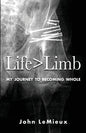 Life is Greater Than Limb: My Journey to Becoming Whole - Paperback