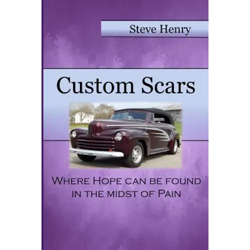 Custom Scars: Where Hope Can Be Found in the Midst of Pain - Paperback