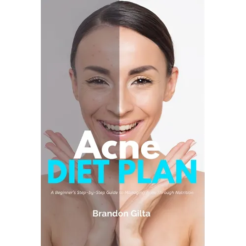 Acne Diet Plan: A Beginner's Step-by-Step Guide to Managing Acne Through Nutrition With Curated Recipes and a Sample Meal Plan - Paperback